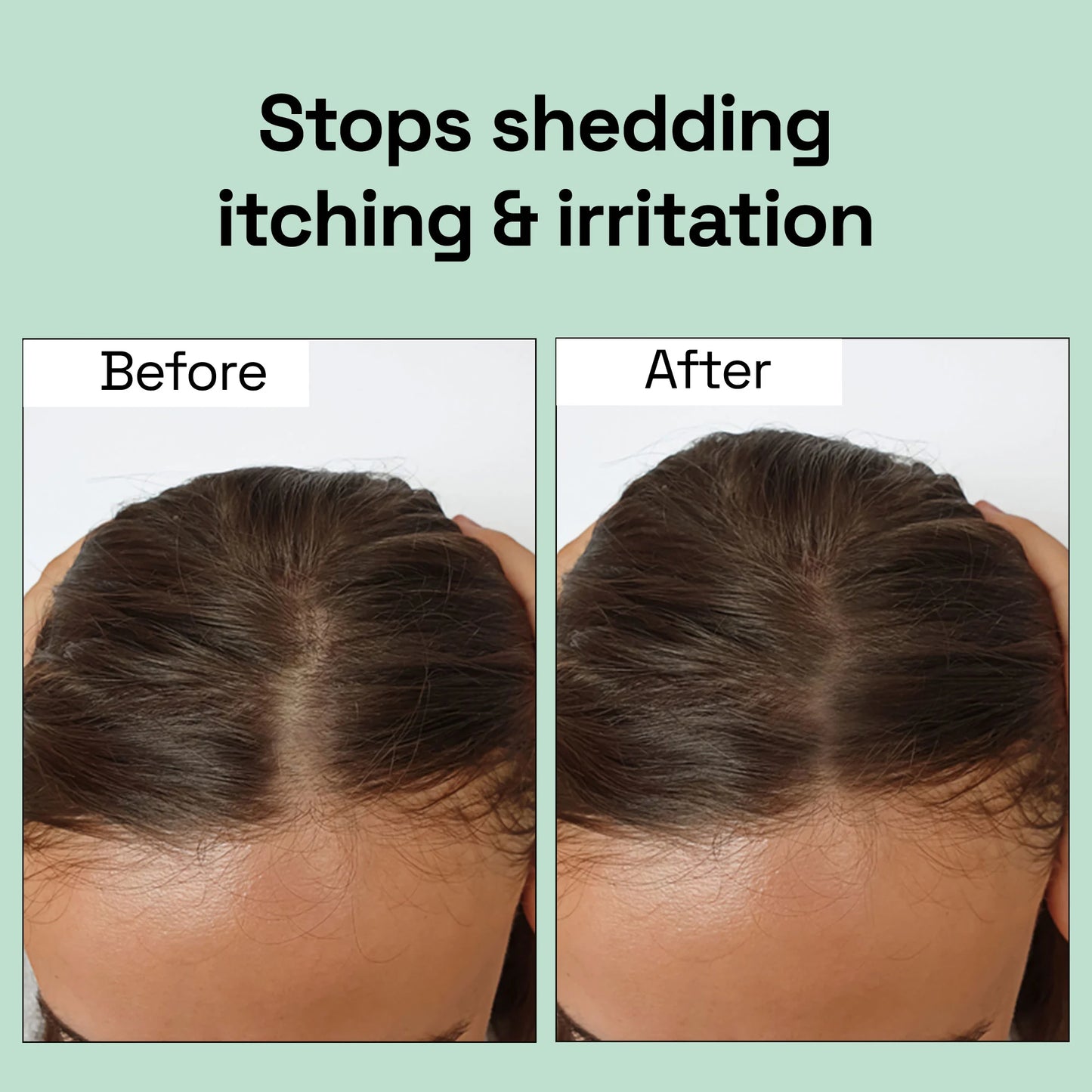 Rosemary Mint Light Hair Growth Oil