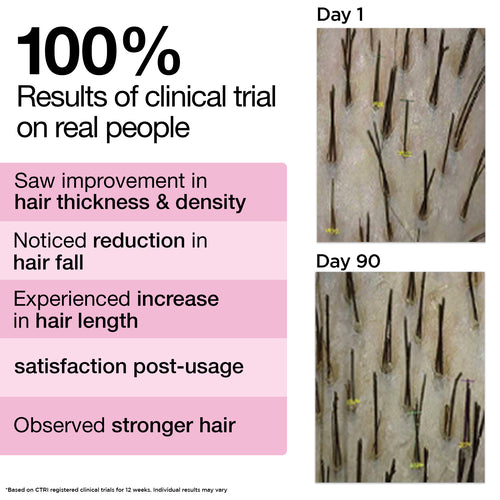 Clinically Proven Rosemary Lavender Hair Oil for 2X New Regrowth