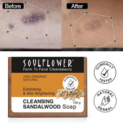Improved results from using organic homemade sandalwood soap.