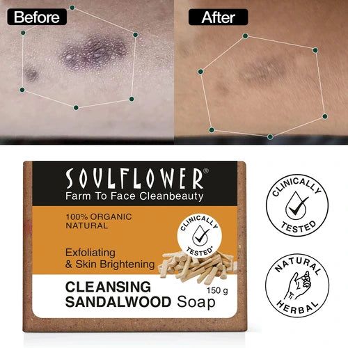 organic homemade sandalwood soap before after skin improvement