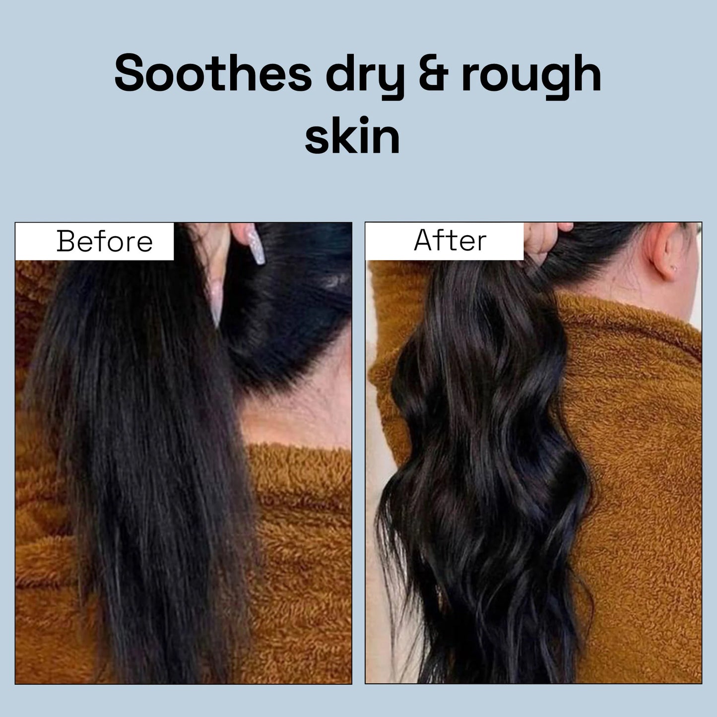 Tea Tree Anti Dandruff Scalp Oil