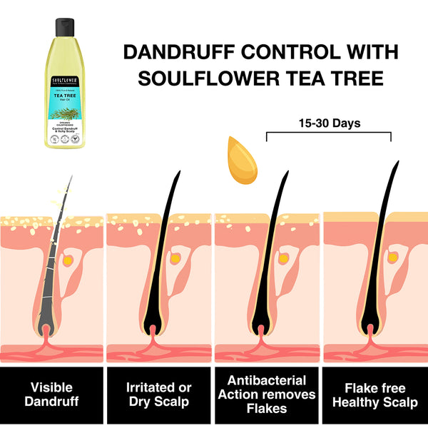 Complete Routine for Excessive Dandruff