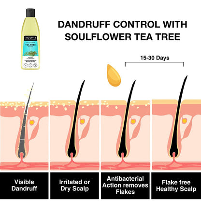Complete Routine for Excessive Dandruff