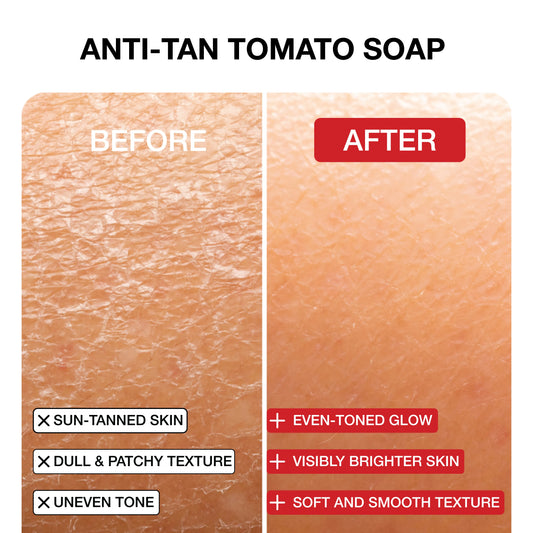 Anti-Tan Juicy Red Tomato Soap