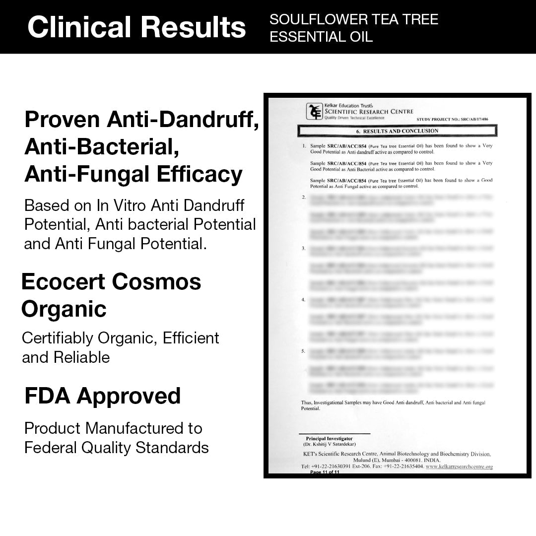 Clinically proven results: Soulflower Anti-Dandruff Routine reduces dandruff by 86% and itching by 83% after 4 washes, with long-lasting scalp relief.