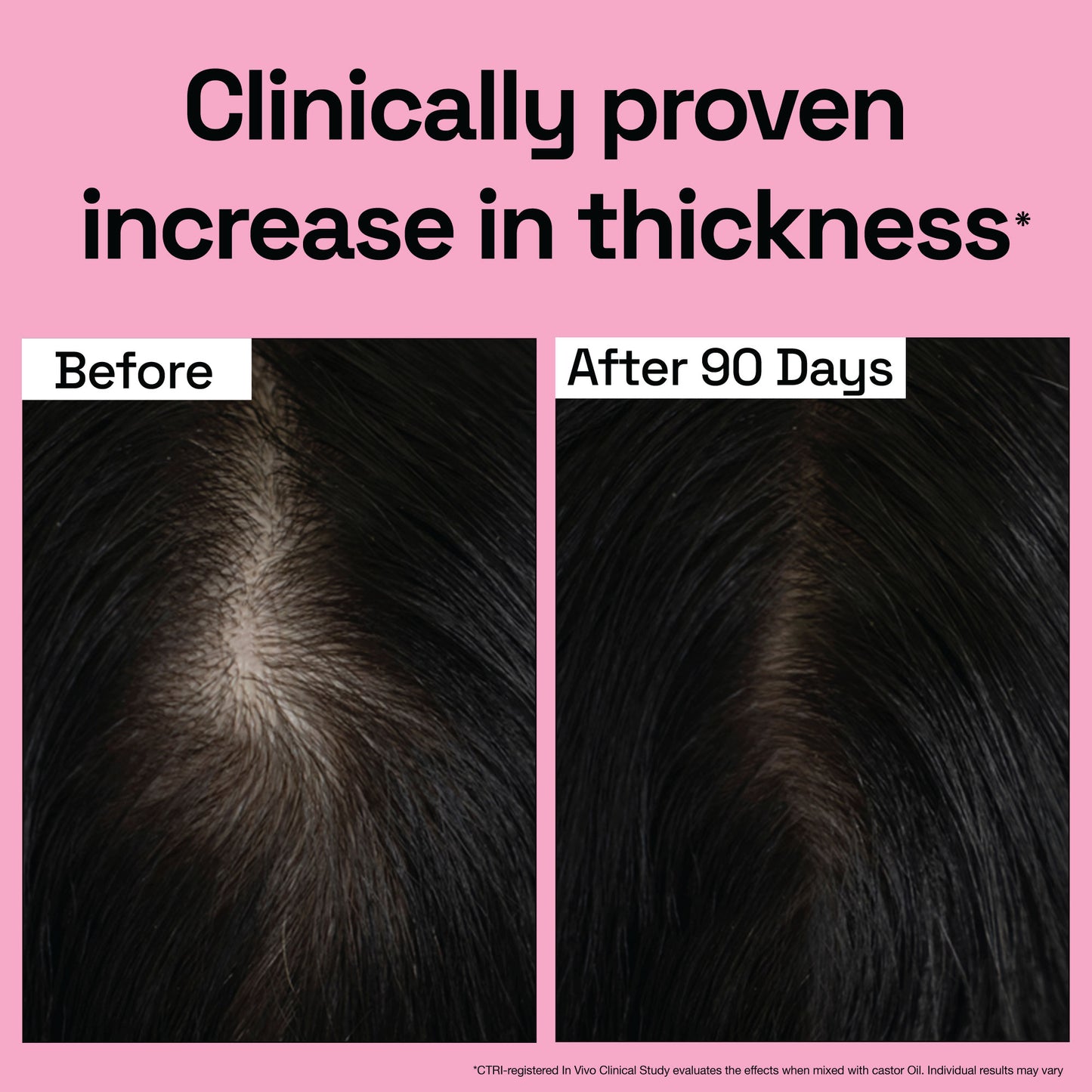 Rosemary Essential Oil