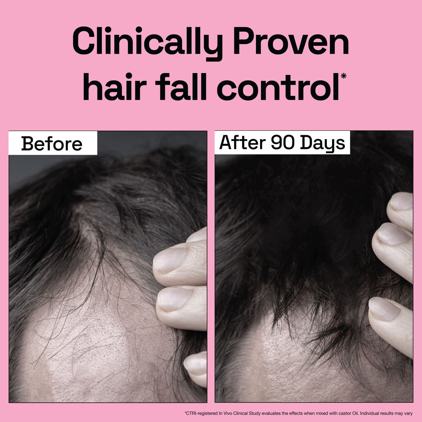 Rosemary Essential Oil