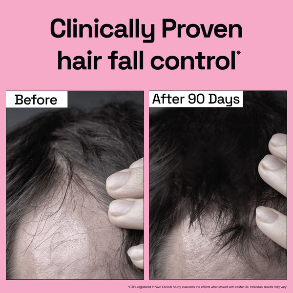 Rosemary Essential Oil