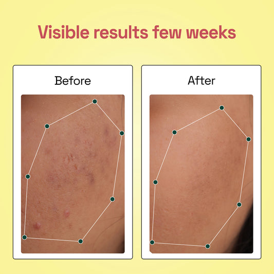 Strawberry Glow Soap for Natural Tinted Cheeks